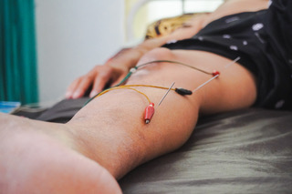 Electroacupuncture treatment on patient's knee at The Zen Point in Bethesda MD